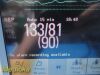 PHILIPS Intellivue MP50 Critical Care Patient Monitor