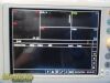 PHILIPS VS3 SureSigns 863073 Spot Vitals Monitor