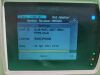 PHILIPS IntelliVue MP2 Patient Monitor