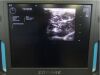 ZONARE ZS3 Ultrasound