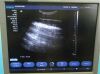 SIEMENS ACUSON X300 PE Ultrasound