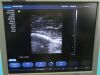 SIEMENS ACUSON X300 PE Ultrasound