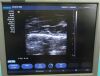 SIEMENS ACUSON X300 PE Ultrasound