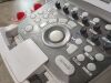 KONICA SONOVISTA GX30 Ultrasound - OB / GYN
