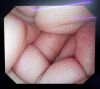 OLYMPUS GIF-Q240X Endoscope