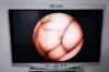 KARL STORZ 11301BND1 Endoscope