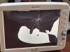 BIONET BM5 Monitor