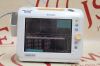 PHILIPS SureSigns Monitor