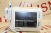 PHILIPS SureSigns Monitor