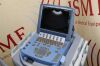 SONOSITE P04538-10 MicroMaxx w/ C60e/2 MHz P07633-21 and ICT/8-5 MHz  Probes