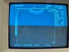 SIEMENS GM6705A2A00 Sonoline Adara Diagnostic Ultrasound