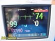 PHILIPS VS3 SureSigns 863073 Spot Vitals Monitor