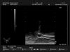 HITACHI EUP-U533 Ultrasound Transducer