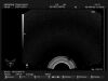 HITACHI EUP-U533 Ultrasound Transducer