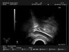 HITACHI EUP-U533 Ultrasound Transducer