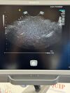 ACUSON/SIEMENS Acuson 9EVF4 Ultrasound Probe / Transducer