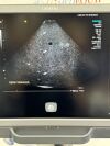 ACUSON/SIEMENS Acuson 4V1 Ultrasound Probe/ Transducer