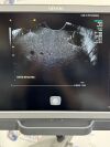 ACUSON/SIEMENS Acuson 9EVF4 Ultrasound Probe/Transducer
