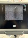 ACUSON/SIEMENS Acuson 12L4 Ultrasound Probe/ Transducer