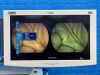 KARL STORZ S Spies TC200, TC300, TC301 and TH100  complete tower Laparoscope