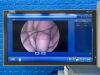 KARL STORZ S Spies TC200, TC300, TC301 and TH100  complete tower Laparoscope