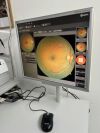 ZEISS Cirrus 800 OCT