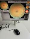 ZEISS Cirrus 800 OCT