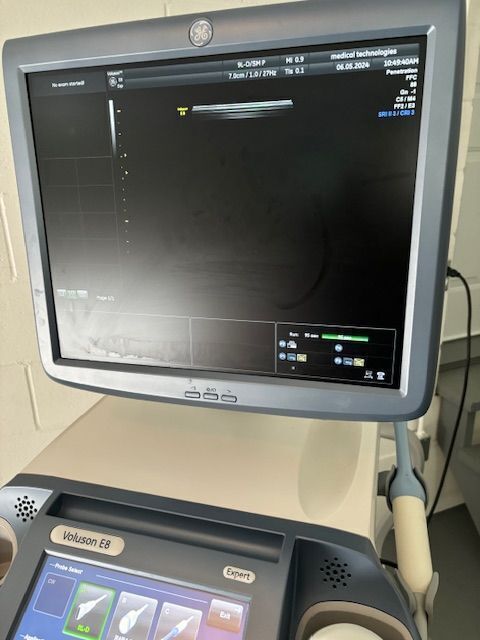 GE Voluson E8 Expert Ultrasound - OB / GYN