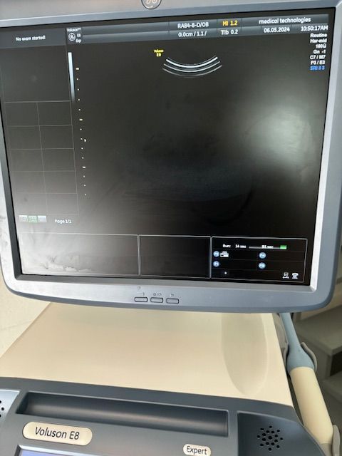 GE Voluson E8 Expert Ultrasound - OB / GYN