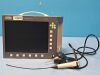 KARL STORZ - ENDOSKOPE Tele Pack X LED TP 100 w/ Karl Storz 11101 VNS Camera