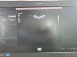 PHILIPS Affiniti 70G  Ultrasound Machine