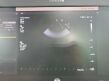 PHILIPS Affiniti 70G  Ultrasound Machine