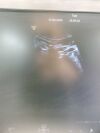 GE Voluson S8 Ultrasound System Year 2017