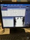 NEUSOFT 2016 NeuViz 16 CT Scanner