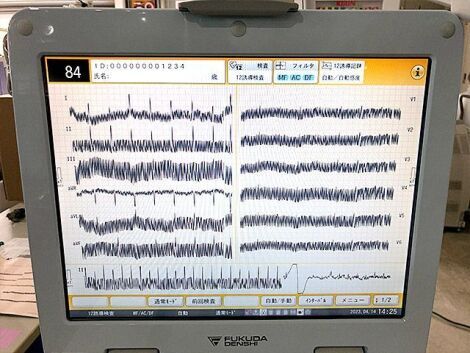 FUKUDA DENSHI FCP-8700 ECG unit