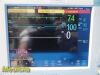 PHILIPS Intellivue MP50 Anesthesia Monitor