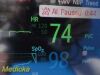 PHILIPS Intellivue MP50 Anesthesia Monitor