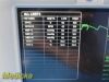 GE Dash 3000 (NBP,Temp,SpO2,ECG & Print) Patient Monitor