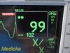 GE Dash 3000 (NBP,Temp,SpO2,ECG & Print) Patient Monitor