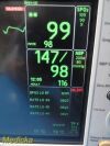 GE Dash 3000 (NBP,Temp,SpO2,ECG & Print) Patient Monitor