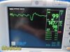 GE Dash 3000 (NBP,Temp,SpO2,ECG & Print) Patient Monitor