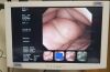 OLYMPUS CF-Q260DL Colonoscope