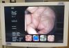 OLYMPUS CF-Q260DL Colonoscope