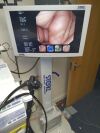 OLYMPUS CF-Q260DL Colonoscope