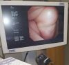 OLYMPUS CYF-240 Cystoscope