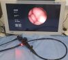 OLYMPUS GIF-1T30 Gastroscope