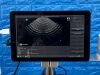VITACON VitaScan LT  With Vitascan V2 Probe. Urology Ultrasound