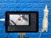VITACON VitaScan LT  With Vitascan V2 Probe. Urology Ultrasound