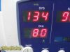 WELCH ALLYN 53NTO Spot Vitals  W/ New Battery, Leads & Power Supply~ Monitor