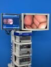 KARL STORZ Image 1  Spies TC 200, TC300 with TH102 FI Laparoscope